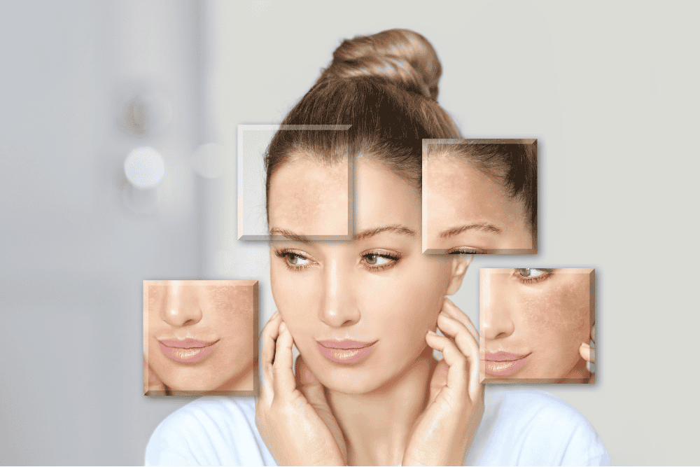 إصلاح حاجز البشرة